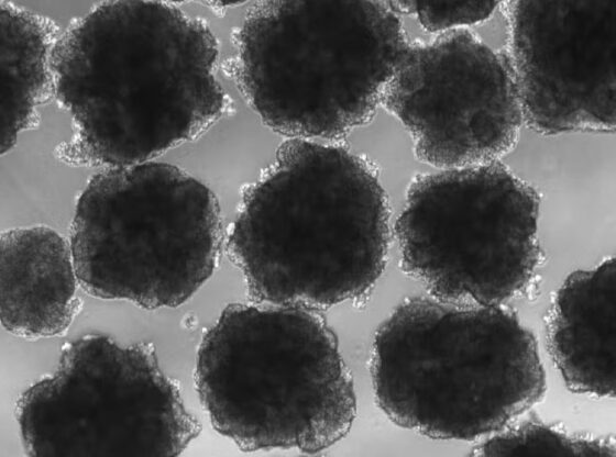 Study reveals that human ancestors were exposed to lead millions of years ago