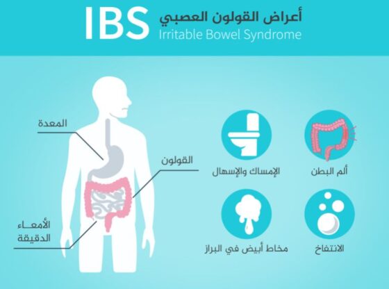 Symptoms of irritable bowel syndrome