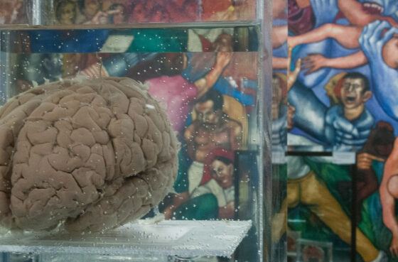 Map of the human brain.